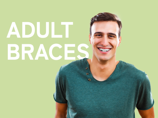 Adult Braces