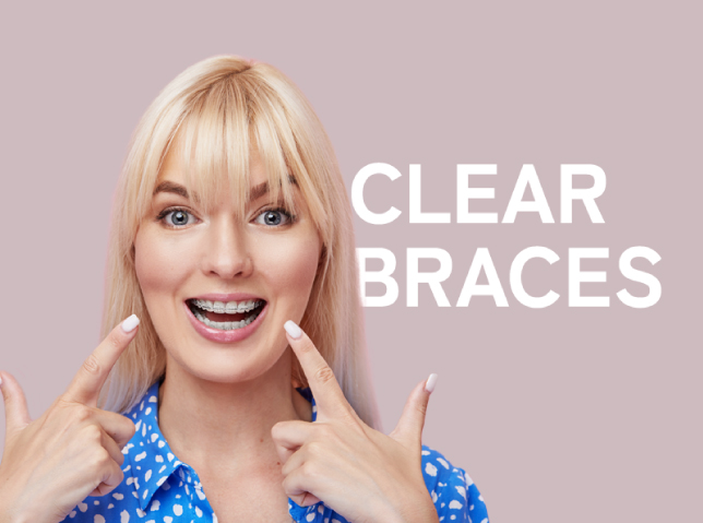 Clear Braces